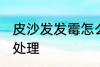 皮沙发发霉怎么处理 皮沙发发霉如何处理