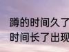 蹲的时间久了腿会麻通常是因为 蹲的时间长了出现了腿的麻木的原因
